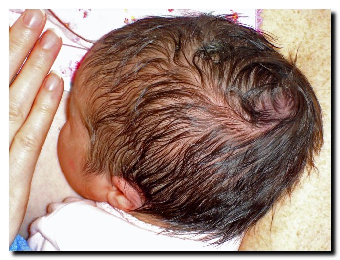 See my hair - that gave my mom heartburn so it did!