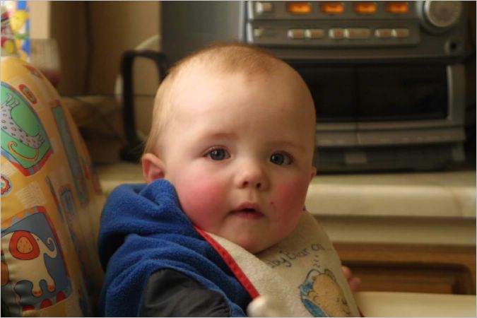 Poor Jordie was teething