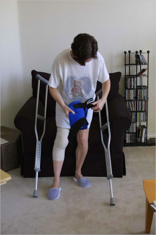 My knee was very swollen for a week following surgery. It had a lot of fluid buildup which ached and ached! Poor me! 